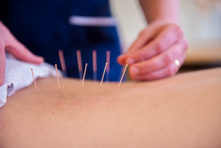 about jane page acupuncture